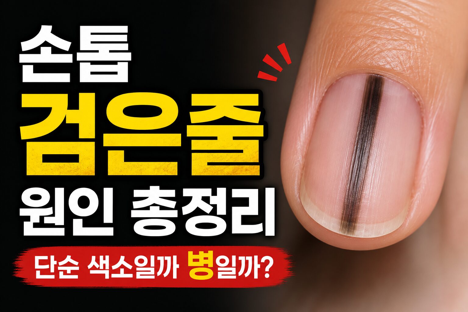 손톱 검은줄 원인 총정리